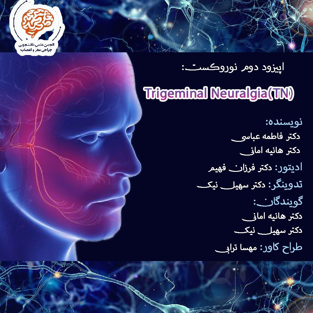 Trigeminal Neuralgia