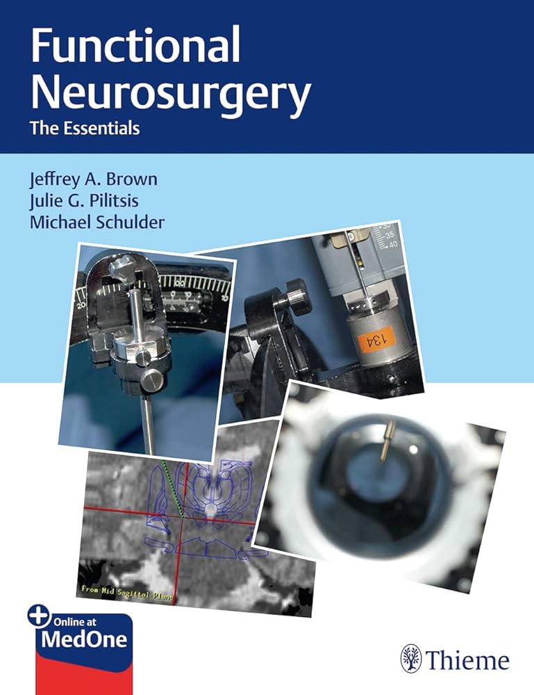 جراحی مغز و اعصاب عملکردی چیست؟  Functional Neurosurgery